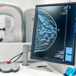 A mammogram displayed on a computer monitor